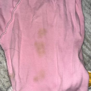 Arçelik Çamaşır Makinesi Sorunu Ve Yetersiz Müşteri Hizmeti