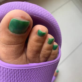 Kostarika Güzellik Merkezi Protez Tırnak Hizmetinde Enfeksiyon Ve Saygısızlık!