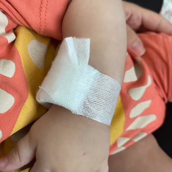 Bebek Yoğun Bakımda Damar Yolu Sorunu