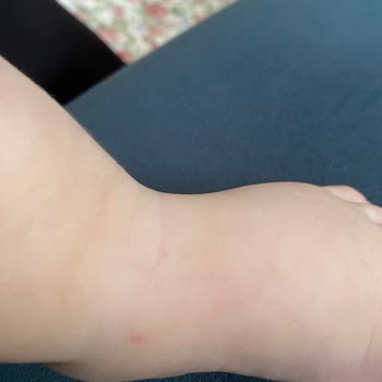 Bebek Yoğun Bakımda Damar Yolu Sorunu