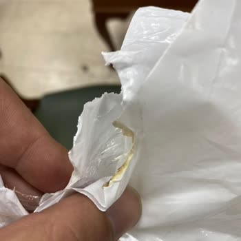 Yanmış Ürün Teslimatı Ve İade Sürecinde Mağduriyet