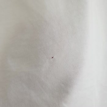 Gant Kıyafette Beklenmedik Delik Ve Yetersiz Müşteri Hizmetleri