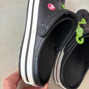 Amazon Türkiye: Sipariş Hataları Ve Kusurlu Ürünler