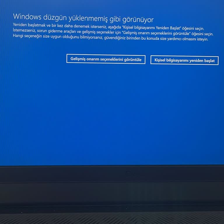Vatan Bilgisayar'dan Alınan Dell Notebook'un Kurulum Sorunları Ve Yetersiz Müşteri Hizmeti