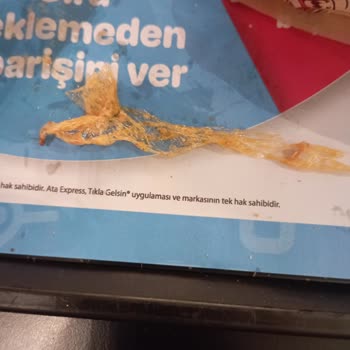 Dönerin İçinden Streç Film Çıktı: Sağlığımız Tehlikede Mi?