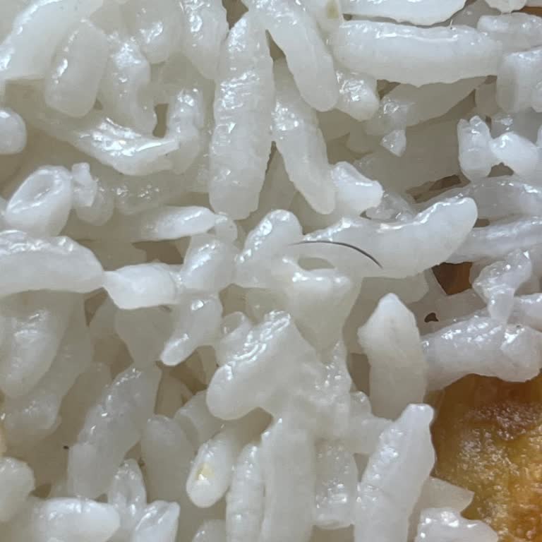 Hijyen Sorunu Ve İlgisiz Personel