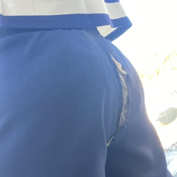 Koton'dan Aldığım Üründe Beklenmedik Sorun Ve Müşteri Hizmeti Deneyimi