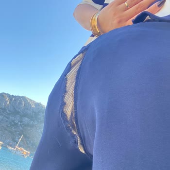 Koton'dan Aldığım Üründe Beklenmedik Sorun Ve Müşteri Hizmeti Deneyimi