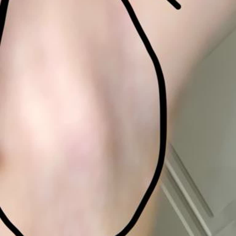 Nivea Cherry Blossom Roll-On Ciltte Ağrı Yapan Beze Oluşturdu