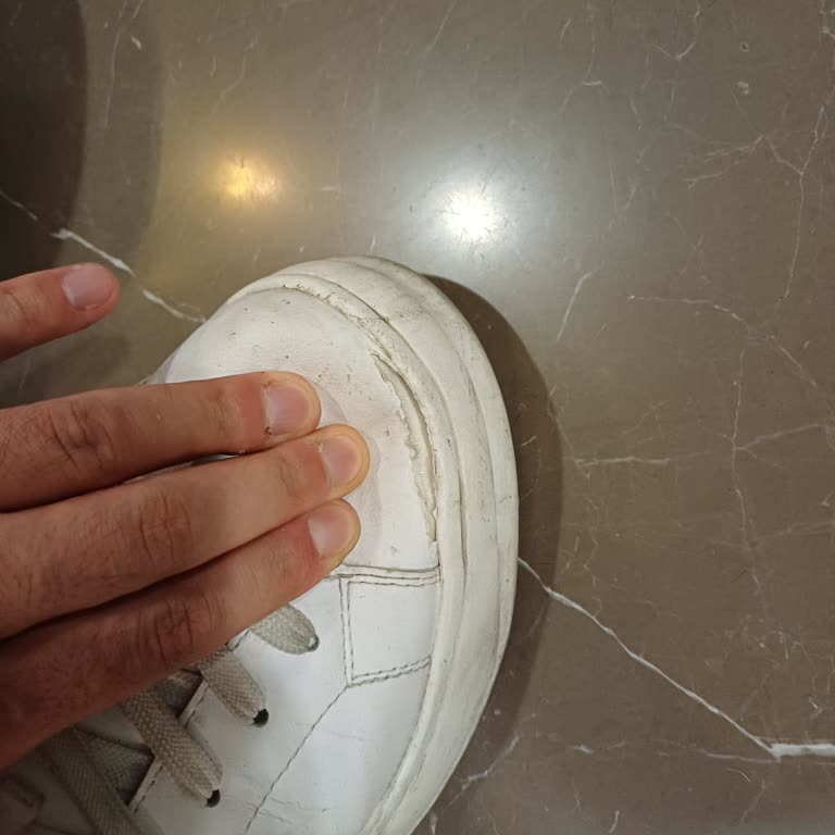 Zara Shoes Fell Apart After One Month – Can’t Reach Customer Service for Help