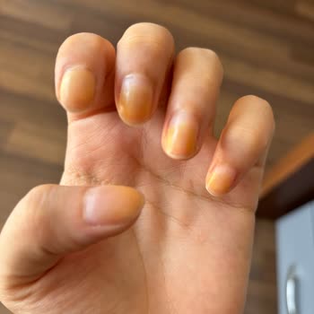 Flormar Ojesi Tırnaklarımı Sararttı Ve İnceltti