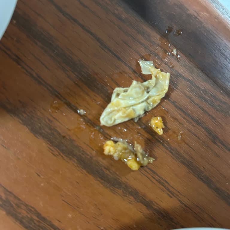 Yemekhanede Plastik Eldiven Şoku
