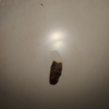 A101'den Alınan Sütte Şok Edici Yabancı Madde