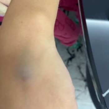 Hastanede Yetersiz Hizmet Ve İlgisizlik