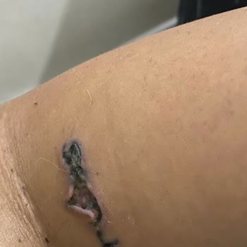 Mayya Aesthetic Şikayeti