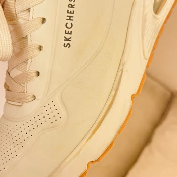 Skechers Ayakkabının Kalitesiz Malzeme Sorunu