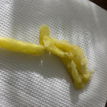 Burger King Siparişimde Hijyen Sorunu: Patateste Saç Teli!