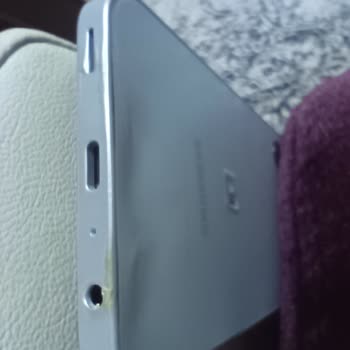 Kasko Sigortası Mağduriyeti: Eksik Onarım Ve İlgisiz Hizmet