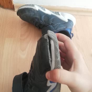 Skechers Ayakkabıda Şok Edici Kalite Sorunu