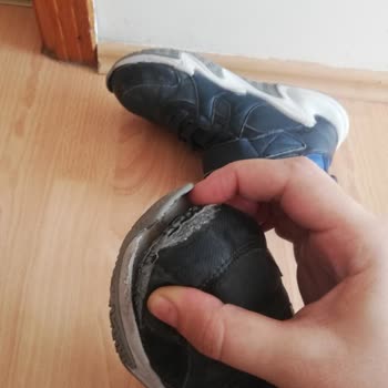 Skechers Ayakkabıda Şok Edici Kalite Sorunu