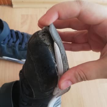 Skechers Ayakkabıda Şok Edici Kalite Sorunu