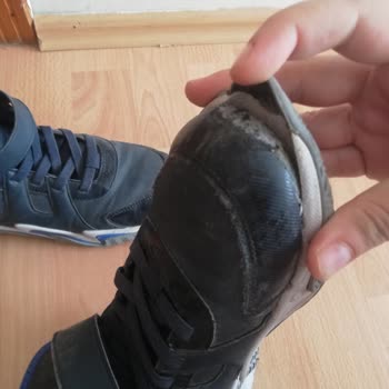 Skechers Ayakkabıda Şok Edici Kalite Sorunu