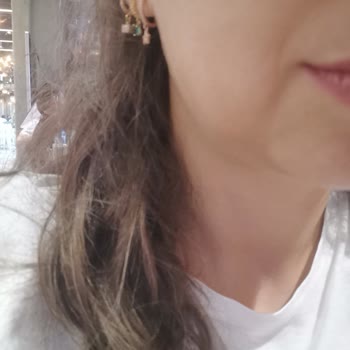 Hayal Kırıklığı Yaratan Estetik Deneyim