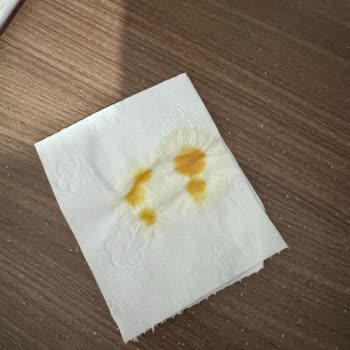 Eki aç