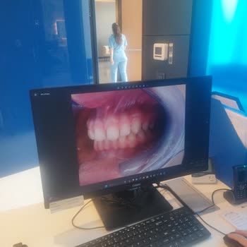 Diş Teli Tedavisinde Yaşanan Sorunlar Ve Kötü Muamele