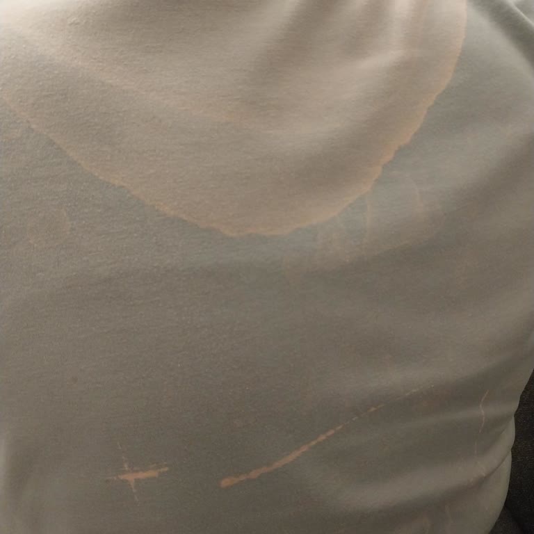 Saç Boyama Ve Kesiminde Beklenmedik Sorunlar