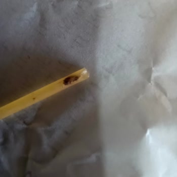 Hijyen Skandalı: Makarnadan Çıkan Böcek!