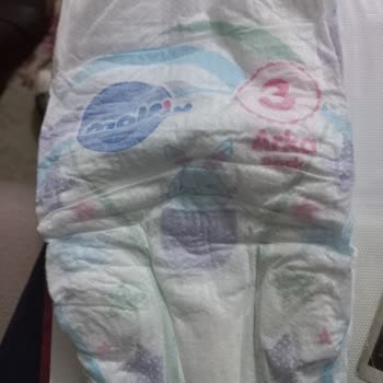 Molfix 3 Numara Bezde Islaklık Göstergesi Eksikliği