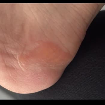 Kinetix Ayakkabı Mağduriyeti: FLO'dan Beklenmedik Olumsuz Sonuç