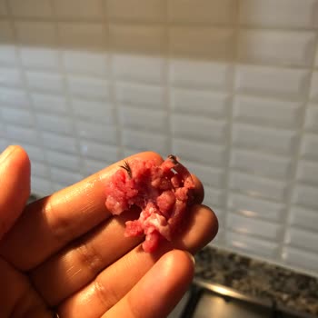 Hijyen Skandalı: Üründe Kıl Ve Kanat Bulundu!