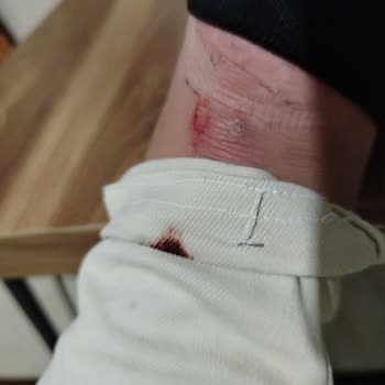 Puma Ayakkabılar Ayağımı Mahvetti