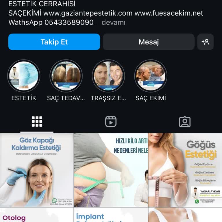 Fue Estetikte Fatura Yok, Sağlık Riski Yüksek!