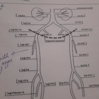 Anjiyo Randevusu Ve Eksik Bilgilendirme Sorunu