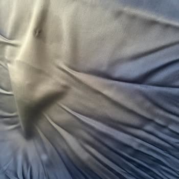 Renk Solması Ve Müşteri Hizmetleri Sorunu