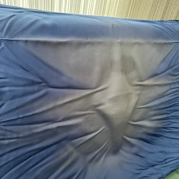 Renk Solması Ve Müşteri Hizmetleri Sorunu