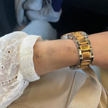 Garanti Sürecinde Hayal Kırıklığı: Renk Atan Saat Ve Haksız Kullanıcı Hatası İddiası