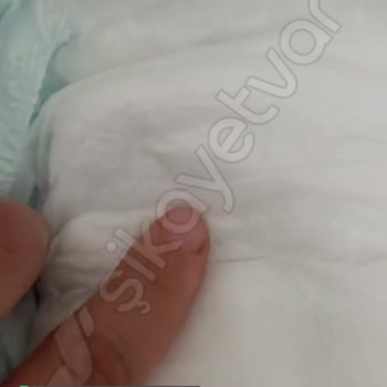 Jenny & Willy Çocuk Bezi Şikayeti