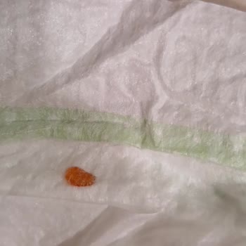 Bebek Bezinde Yabancı Madde Şoku!