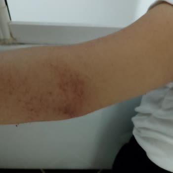 H&M Polarlar Yıkandıktan Sonra Renk Verdi