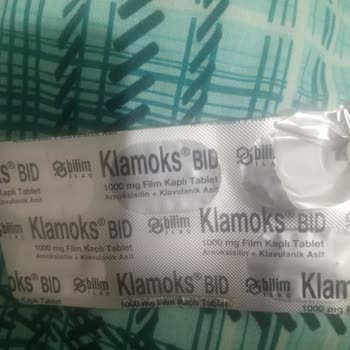 Okan Üniversitesi Diş Hastanesi Yanlış Anestezi Sonrası Çene Felci Ve Tamamlanmayan Diş Tedavisi!