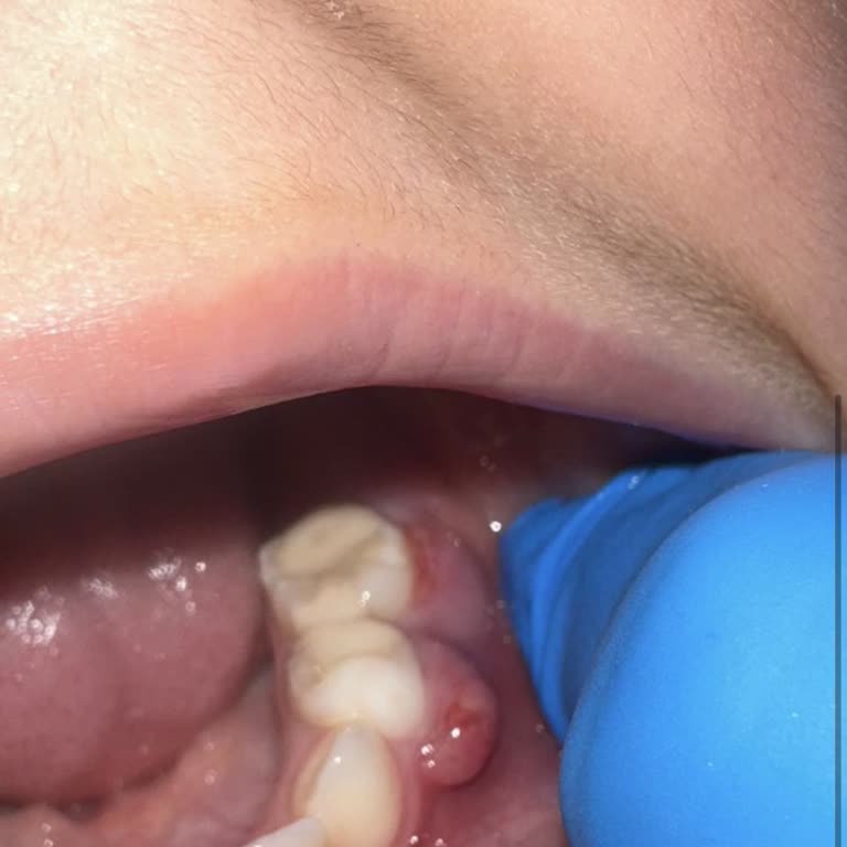 Dentislife Ağız Ve Diş Sağlığı Polikliniği Şikayeti