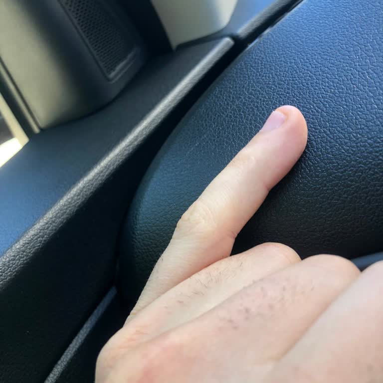 Hyundai Assan Aracın Korumasız Müdahalesi Sonrası Çizik Sorunu