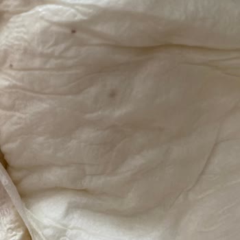 Sleepy Bebek Bezlerinde Şüpheli Siyah Noktalar