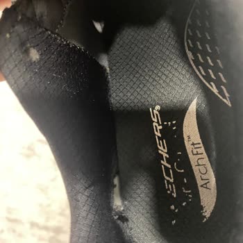 Skechers Ayakkabıda 3 Ayda Deformasyon Ve Değişim Sorunu
