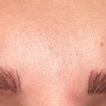 Kaş İşleminde Hatalı Uygulama Ve Müşteri Memnuniyetsizliği