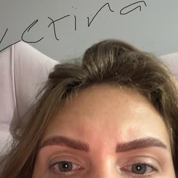 Kaş İşleminde Hatalı Uygulama Ve Müşteri Memnuniyetsizliği